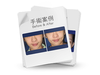 Wish-Home-SurgeryBeforeAfter-BG8